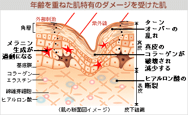 �N����d�˂������L�̃_���[�W���󂯂���